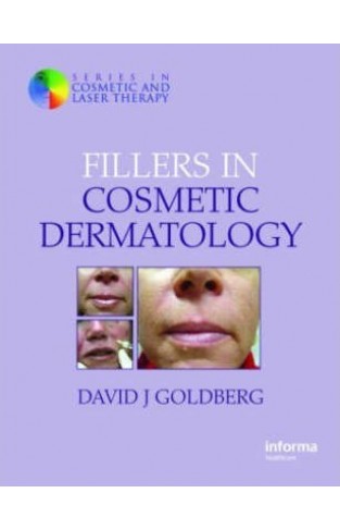 Filers in Cosmetic Dermatology - (HB)